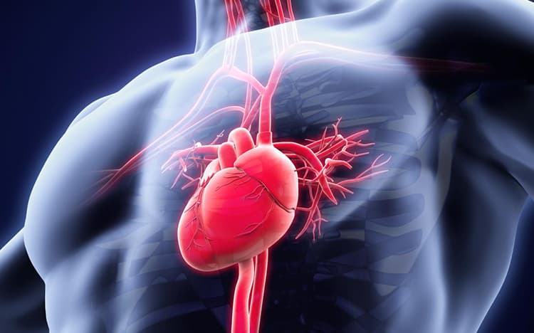 Taquicardia ventricular
