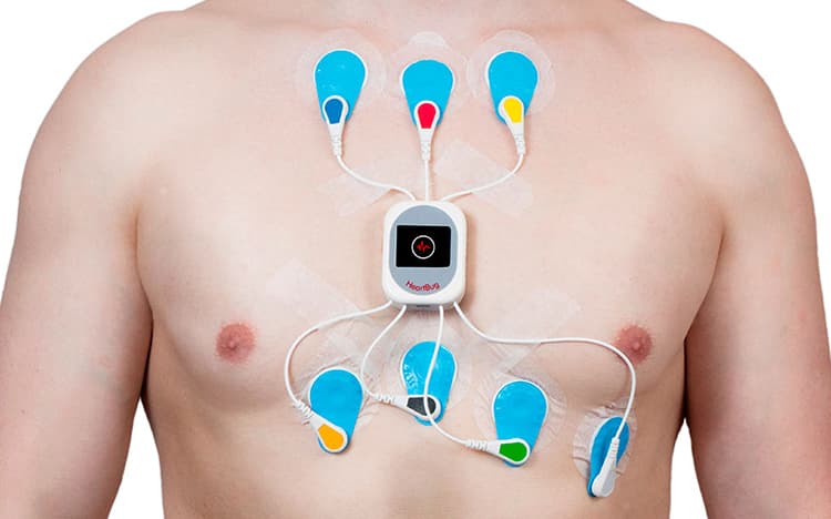 Holter de 24/48 horas